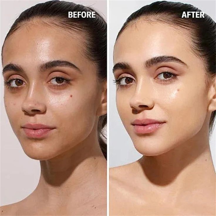 C-Radiance Vitaboost(vitamin c serum)