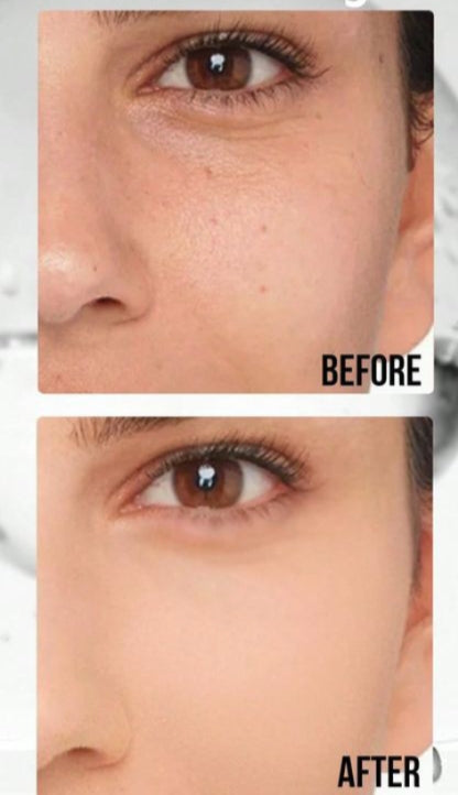 HydraBoost (Hyaluronic + B5 serum)